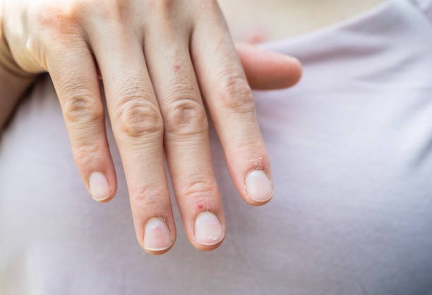 Common Nail Signs That Reveal Health Issues.