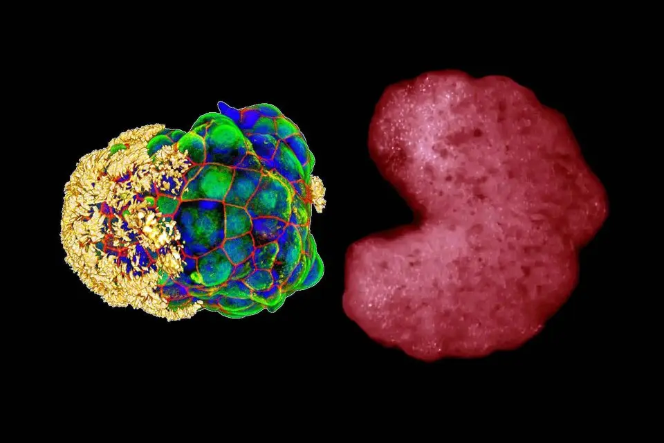 third-state-of-life-human-cells-active-after-death